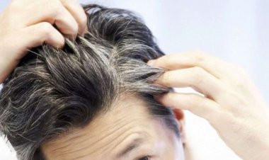 ما أسباب ظهور الشعر الأبيض؟